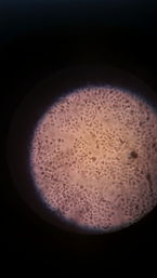 Foto von abgestorbenen HeLa-Zellen (mit CT behandelt), 8 k