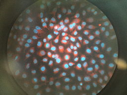 Foto von einer Fluoreszenzmikroskopie, 12 k