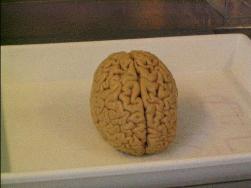 Bild eines Gehirns, 26 k