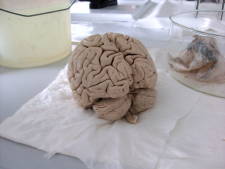 Ein Gehirn in Formalin eingelegt und rechts im Hintergrund die Kopfhaut, 6k