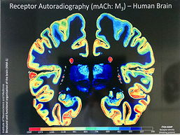 Gehirnschnitte einer Rezeptor-Autoradiographie, 22 k