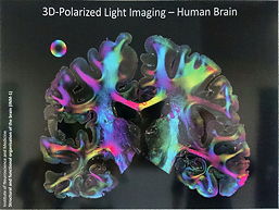 Gehirnschnitte eines 3D-Polarized Light Imaging, 16 k