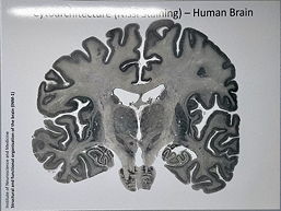 Gehirnschnitte einer Silbernitrat-Färbung, 14 k