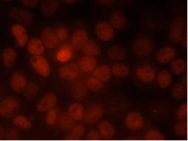 Lokalisierung des Proteins A durch einen fluoreszenz-markierten (rot) Antikörper, 4 k