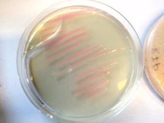 E. coli mit dem Protein (rfp), 12 k